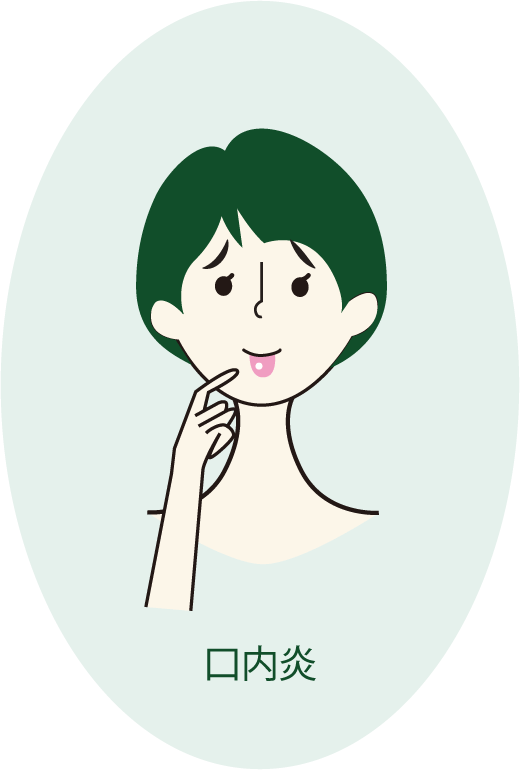 サンクロン 口内炎 効果 イラスト
