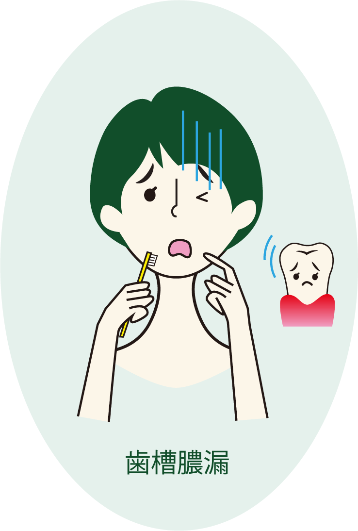 サンクロン 歯周病 歯槽膿漏 効果 イラスト